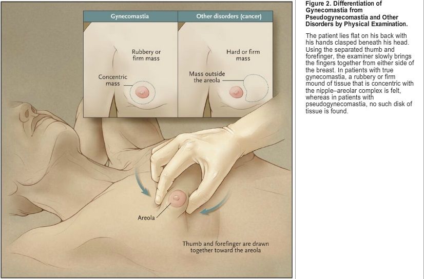 GYNE.jpg?1437181088