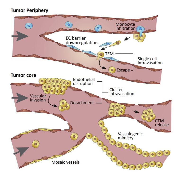 Metastase2